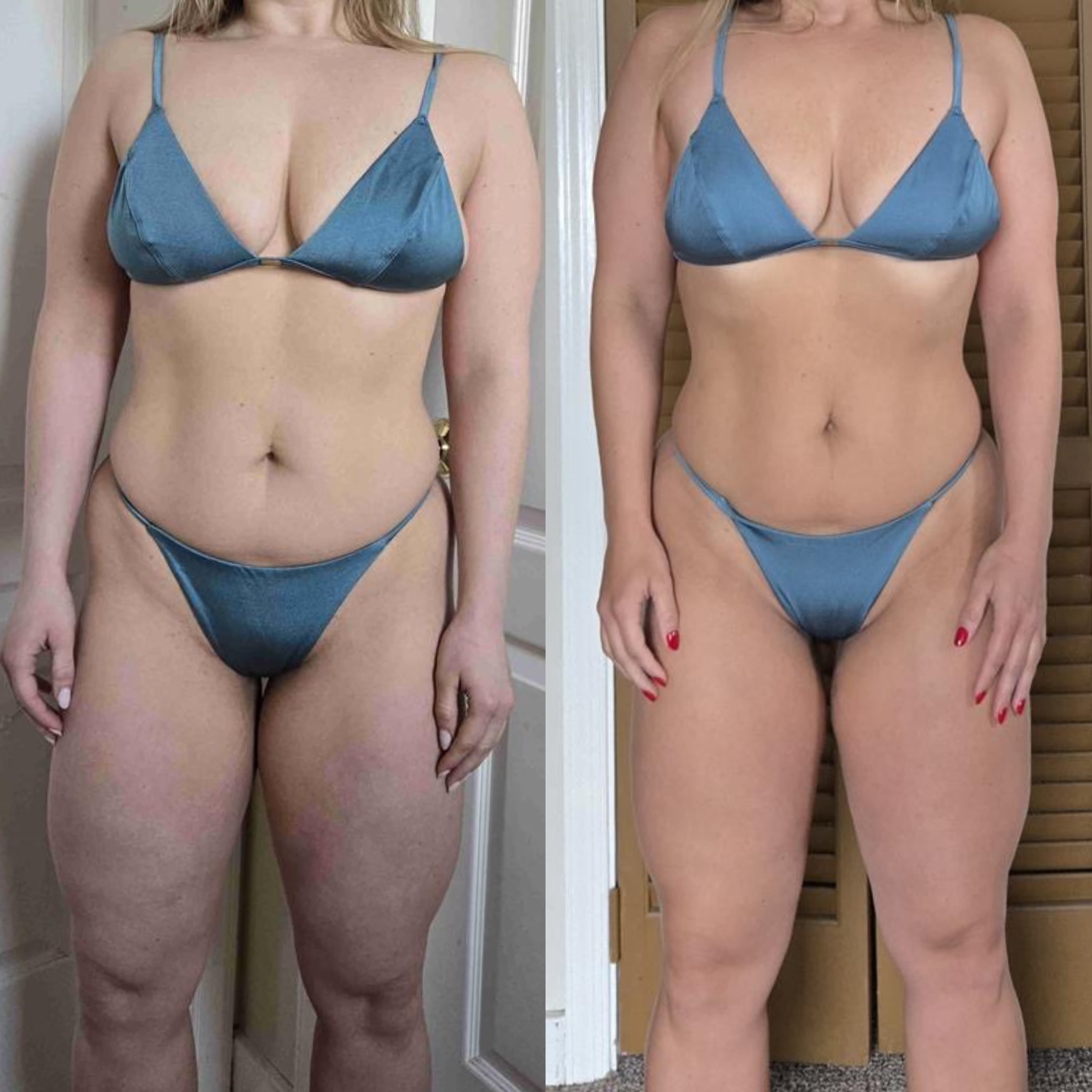 Transformation of Emily P.